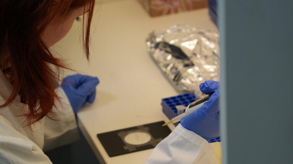 Person befüllt den Probenchip mit der Pipette.